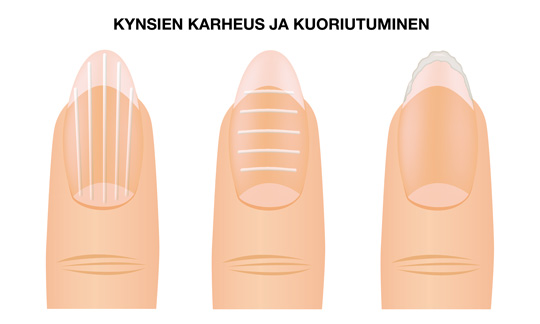 KYNSIEN KARHEUS JA KUORIUTUMINEN